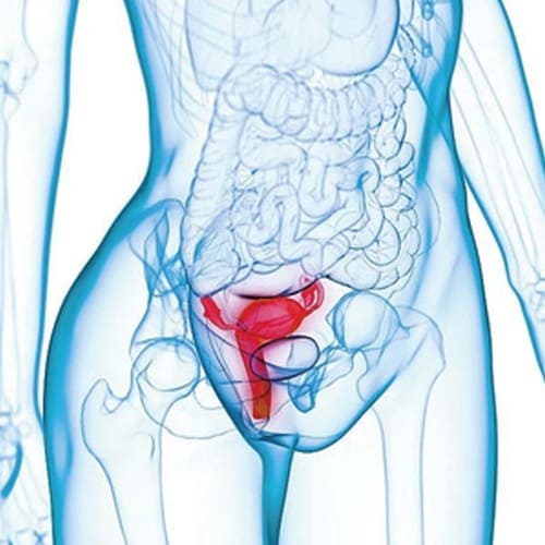 Behandlung vaginaler Erschlaffung